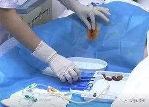 尿道堵视频,尿道堵塞紧急处理与预防指南