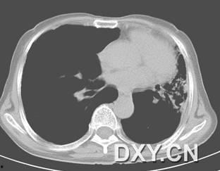 肺部查体视频教程,实用技巧与案例分析